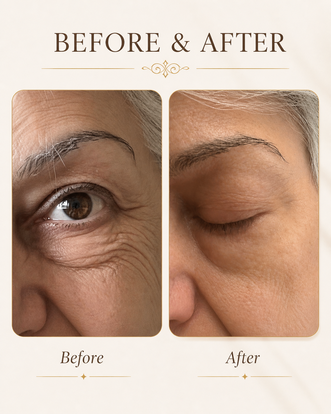 ZIBA Firming Eye Serum — before and after results on mature crow’s-feet, visible smoothing of deep lines.
