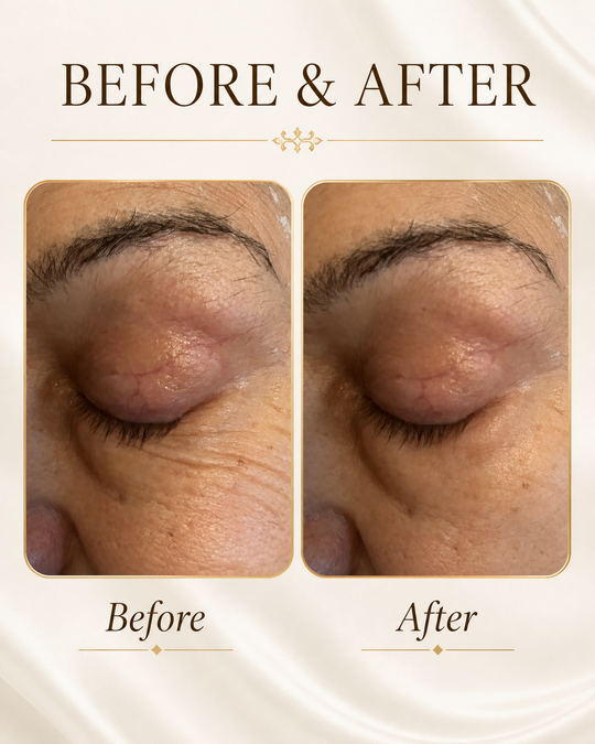 ZIBA Eye Crème — before and after results on the eyelid, visible refinement of texture and fine lines.