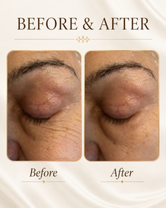 ZIBA Firming Eye Serum — before and after results on eyelid and fine lines.