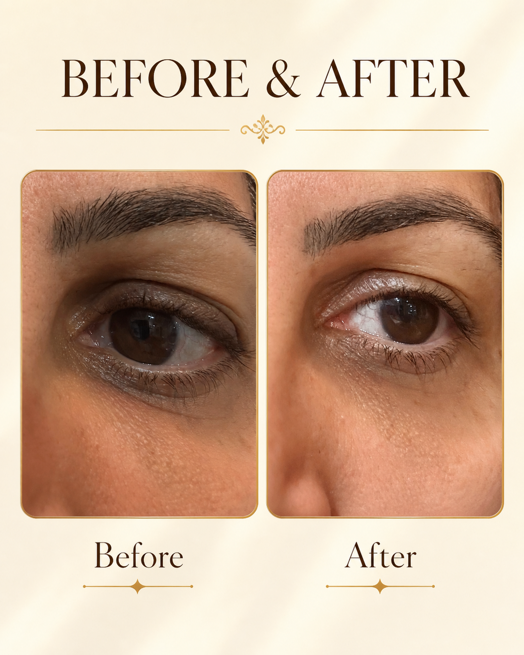 ZIBA Eye Crème — before and after results on the under-eye area.