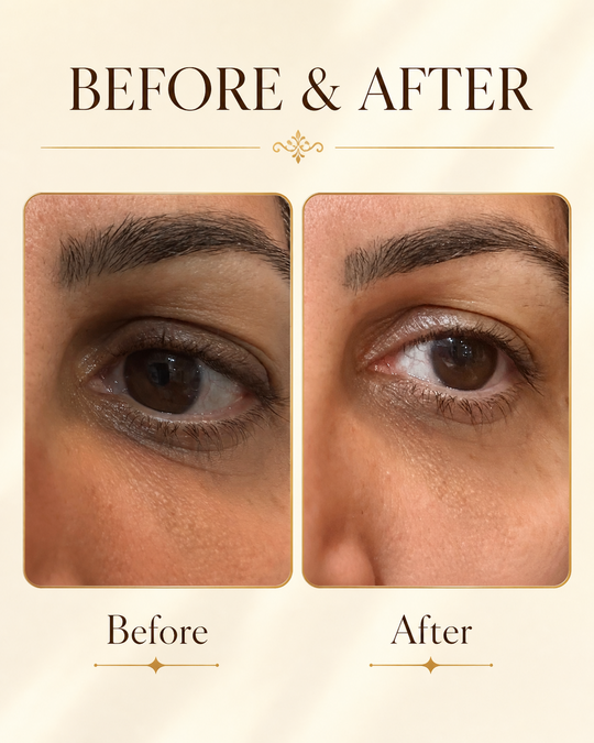 ZIBA Eye Crème — before and after results on the under-eye area.