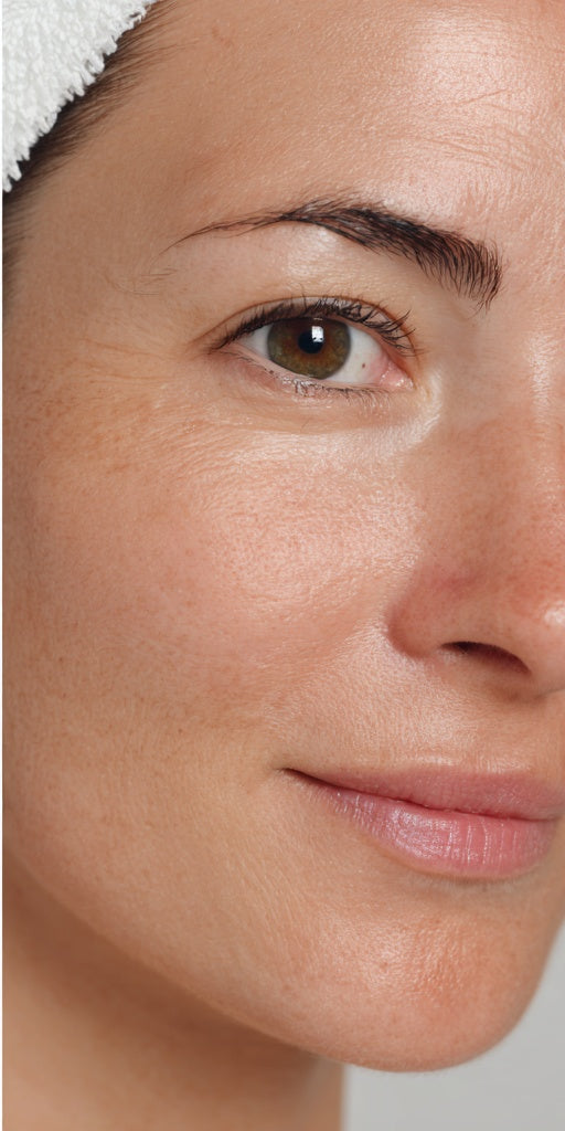 NAAR After - Skin Texture Improved